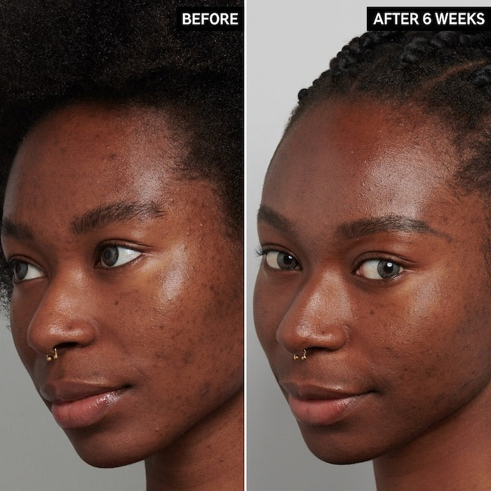 The Inkey List Hyperpigmentation Treatment - 1 oz/30 ml