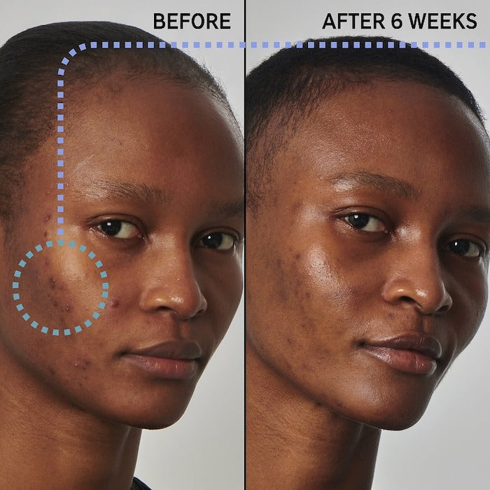 The Inkey List SuperSolutions Balance Skin Oil  Serum - 1 oz /30 ml